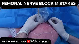 Femoral Nerve Block Common Mistakes  Crash course with Dr Hadzic [upl. by Rech169]