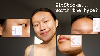 ZitSticka Review AD  What happened after 6 hours [upl. by Vern]