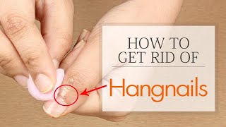 How to Get Rid of Hangnails Fast  Home Remedies for Hangnails Treatment [upl. by Ttam952]