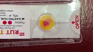 RAPID UREASE TEST FOR H PYLORI  TEST FOR GASTRITIS ULCER hpylori rutkit [upl. by Narf]