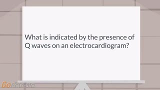 What is indicated by the presence of Q waves on an EKG [upl. by Ainesej998]