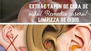 ELIMINA TAPÓN DE CERA EN OÍDOS LIMPIEZA DE OREJAS CON AGUA OXIGENADA PARA CURAR HERIDAS [upl. by Auroora]