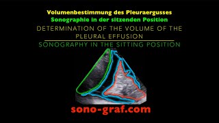 Sonographie  Volumenbestimmung des Pleuraergusses [upl. by Sugirdor253]