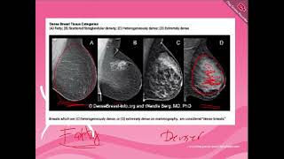 Mammography 1 [upl. by Anoirtac28]