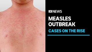 Measles cases are on the rise around the world  ABC News [upl. by Acinoryt]