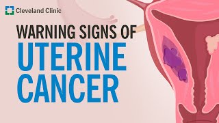 The Most Common Warning Sign of Uterine Cancer [upl. by Errot]