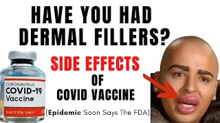 COVID VACCINE SIDE EFFECTS  Dermal Fillers [upl. by Leonore]