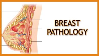 Breast Pathology Inflammatory vs Benign vs Malignant [upl. by Gregoire]