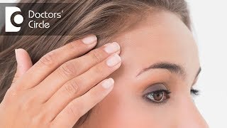 Is Povidone Iodine solution helpful in treating acne  Dr Sudheendra Udbalker [upl. by Magnuson]