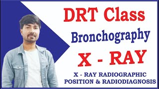 Bronchography Radiology  DRT Class in English  Important Shorts  Prakash Sir [upl. by Gannie149]