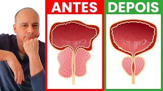 O 1 Nutriente Mais Importante Para Diminuir Sua Próstata [upl. by Mossman]