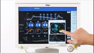 Tutorial Diagnostic View des Dräger PulmoVista 500  EIT Lungenmonitoring [upl. by Vershen327]