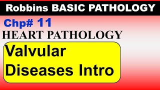 Chp11 Robbins Patho  Heart Pathology  Introduction to Valvular Heart Disease  Dr Asif Lectures [upl. by Hasile]