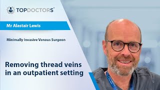 Removing thread veins in an outpatient setting [upl. by Krawczyk]