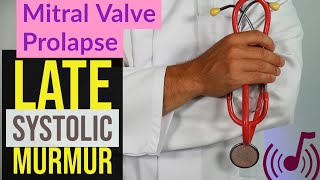 Mitral Valve Prolapse MVP 🩺  Late Systolic Murmur Sound  Auscultation [upl. by Ymor]