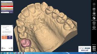 Exocad Dental Cad cofia anatómica 16 [upl. by Anwahsal]