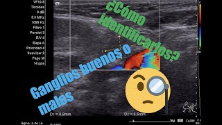 Adenopatías cervicales en niñosDr Daniel Flores [upl. by Nylyak953]