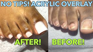 WHITE TOES ACRYLIC TOE NAILS NO TIPS ACRYLIC OVERLAY ON TOES [upl. by Amory147]