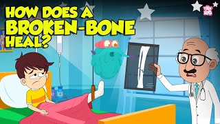 How Bone Fractures Heal  How Does a Broken Bone Heal  Process of Bone Healing  Dr Binocs Show [upl. by Yonit600]