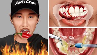 ASMR Animation Treating mouth ulcers and canker sores for Zach Choi [upl. by Newmark]