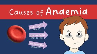 Anaemia causes microcytic normocytic macrocytic  MADE EASY [upl. by Isadora]