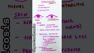 Thyrotoxicosis  Graves disease  Heat intolerance [upl. by Angie341]