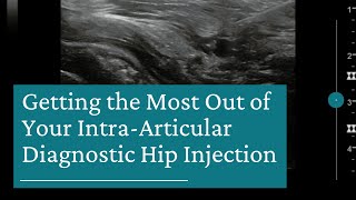 10 Tips for Getting the Most Out of Your IntraArticular Diagnostic Hip Injection [upl. by Naelcm]