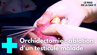 Orchidectomie  une opération pour retirer le testicule malade  Le Magazine de la Santé [upl. by Yrneh]