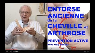 Vidéo Entorse de cheville ancienne ou récidivante  attention à larthrose  par Guy Roulier [upl. by Marisa104]