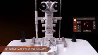 Ellex Selective Laser Trabeculoplasty SLT Animation [upl. by Nol]