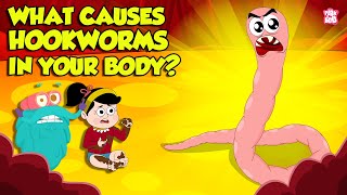 What causes Hookworm। Intestinal Worms Symptoms and Treatment  Worm Infection  Dr Binocs Show [upl. by Boyden39]