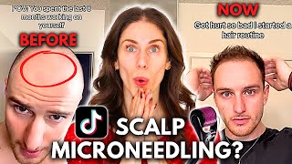 Can You Grow Back Hair With Scalp Microneedling Does Scalp Microneedling Work [upl. by Eintrok]