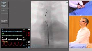 Catheterisation Left and Right Coronary Arteries [upl. by Reste]