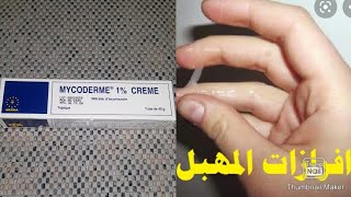 كريم mycoderm العلاج النهائي لحكة المهبل ومشاكل جلدية اخرى مع طريقة استعمال وداعا للافرازات المهبلية [upl. by Nylireg]