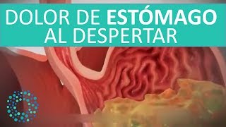 DOLOR de ESTOMAGO al DESPERTAR [upl. by Rist]