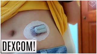 DEXCOM G5 INSERTION Step By Step Tutorial  LainaElyseVlogs [upl. by Harriet]