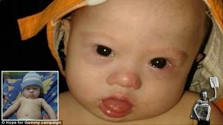 Australian couple leaves Down syndrome baby with Thai surrogate [upl. by Artamas]