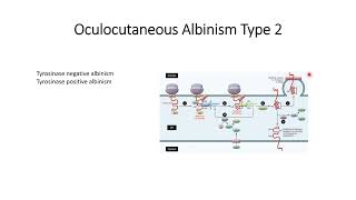 Hypopigmentation  depigmentation Oculocutaneous Albinism Type 2 OCA2 disorder Code211 [upl. by Syverson]