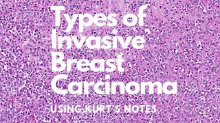 Types of Invasive Breast Carcinoma Kurt’s Notes pathagonia [upl. by Idnam]