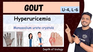 hyperuricemia and gout  gout Pathophysiology  gout nursing  gout  hyperuricemia gout sgsir [upl. by Ylen121]