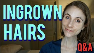 Ingrown hairs how to get rid of them amp skin care tips Dr Dray [upl. by Tybalt805]