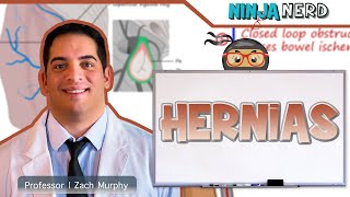 Hernias  Clinical Medicine [upl. by Candy]