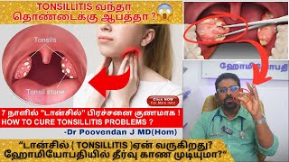 அறுவை சிகிச்சையின்றி டான்சில் Tonsillitis குணப்படுத்த முடியுமாடான்சில் நீக்கினால் என்ன நடக்கும் [upl. by Alaj530]