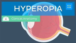 Farsightedness Hyperopia Definition causes symptoms diagnosis and treatment  Kenhub [upl. by Wightman]