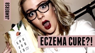 MIRACLE ECZEMA CURE GETGROUNDED  Jambers8 [upl. by Pippa]