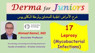 017 Leprosy Mycobacterial Infections د أحمد كامل [upl. by Terbecki]