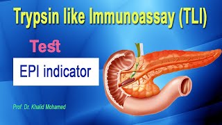 Trypsin like Immunoassay TLI [upl. by Nnaik338]