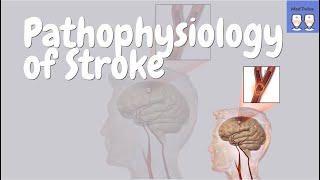 Stroke Pathophysiology Ischaemic VS Haemorrhagic TIAs Signs and Symptoms Treatments [upl. by Odnomar]