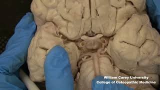 Ventral brainstemhypothalamus neuroanatomy hypothalamus brainstem anatomymedicalstudentbrain [upl. by Beata826]