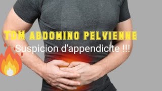 SCANNER ABDOMINOPELVIEN Appendice tuméfié avec épaississement pariétal [upl. by Groeg]